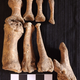 Skeletal remains from Great Chesterford showing evidence of leprosy. This is the oldest known case of leprosy in the UK.
